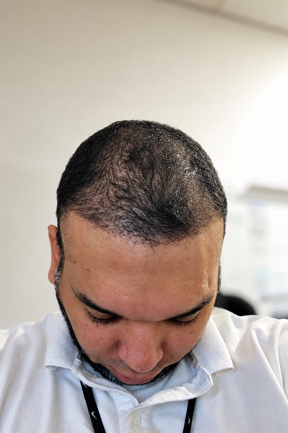 Antes