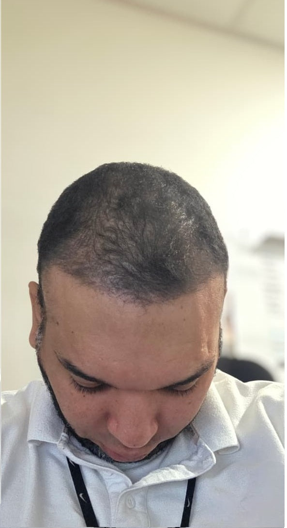 Antes